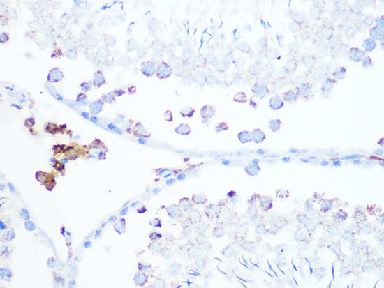 Citrate synthetase Rabbit monoclonal antibody