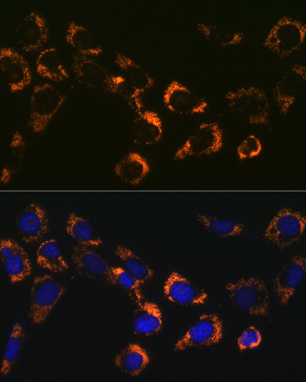 Citrate synthetase Rabbit monoclonal antibody