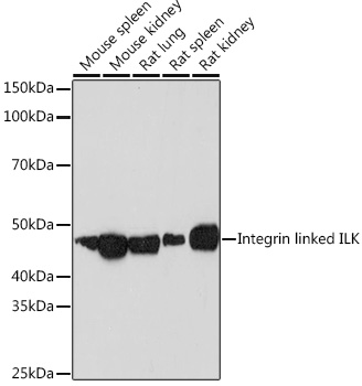 Integrin linked ILK Rabbit monoclonal antibody