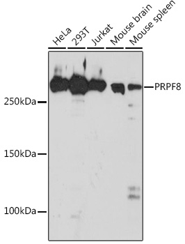 PRPF8 Rabbit monoclonal antibody
