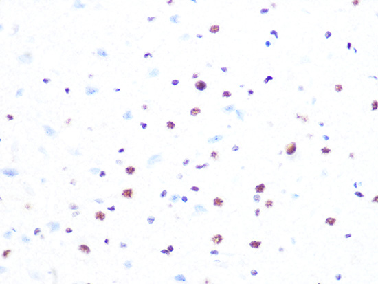 PRPF8 Rabbit monoclonal antibody