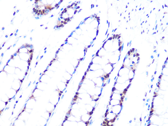 PRPF8 Rabbit monoclonal antibody