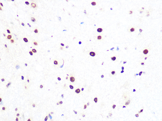 PRPF8 Rabbit monoclonal antibody