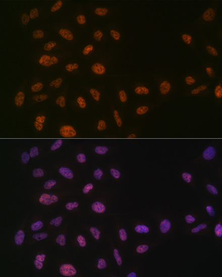 PRPF8 Rabbit monoclonal antibody