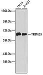 Western blot - TRIM29 Rabbit pAb (A4576)