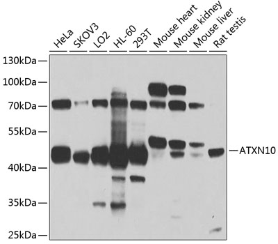 ATXN10 Rabbit polyclonal antibody
