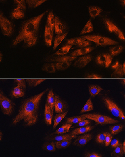 ATXN10 Rabbit polyclonal antibody