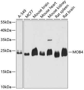 MOB4 Rabbit polyclonal antibody