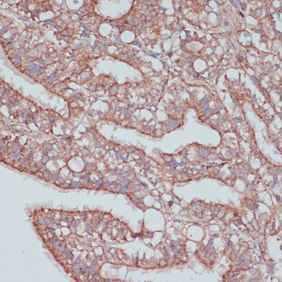 MOB4 Rabbit polyclonal antibody
