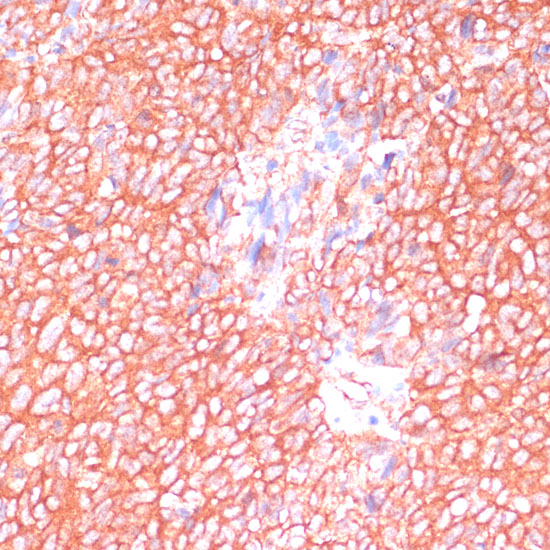 MOB4 Rabbit polyclonal antibody