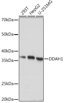 DDAH1 Rabbit monoclonal antibody
