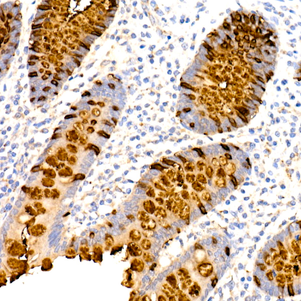 TFF3 Rabbit monoclonal antibody