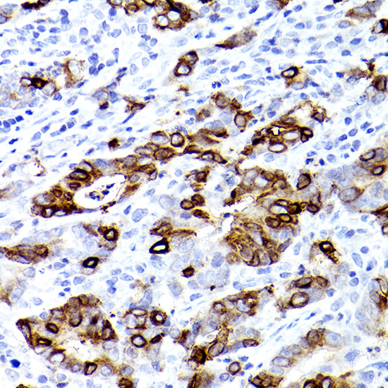 TFF3 Rabbit monoclonal antibody