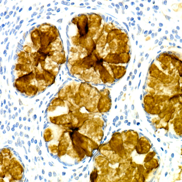 TFF3 Rabbit monoclonal antibody
