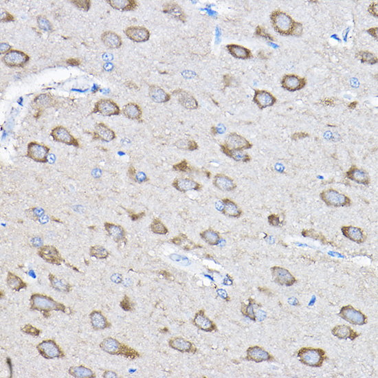 PTPN23 Rabbit polyclonal antibody