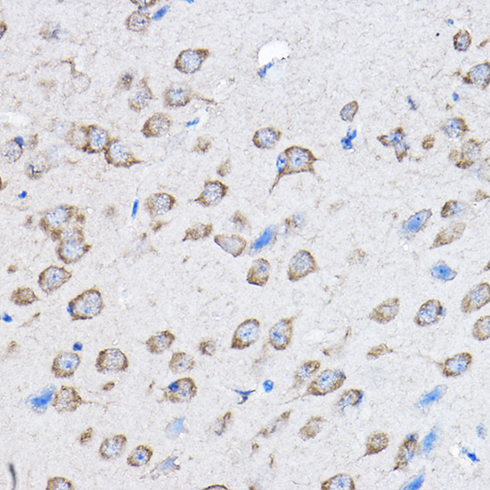 PTPN23 Rabbit polyclonal antibody