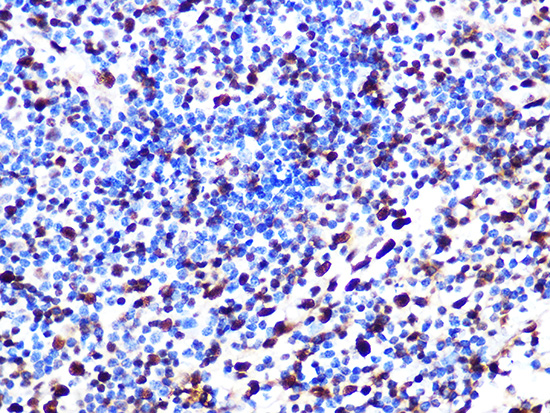 SAMHD1 Rabbit monoclonal antibody