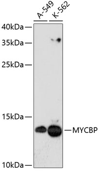 MYCBP Rabbit polyclonal antibody