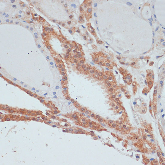 MYCBP Rabbit polyclonal antibody