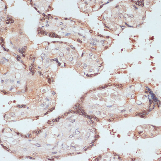 MYCBP Rabbit polyclonal antibody