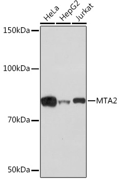 [KO Validated] MTA2 Rabbit monoclonal antibody