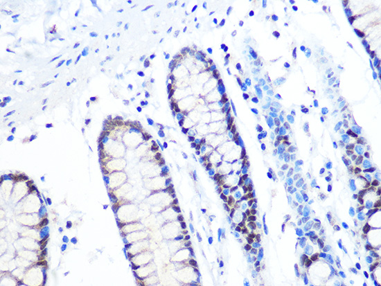 [KO Validated] MTA2 Rabbit monoclonal antibody