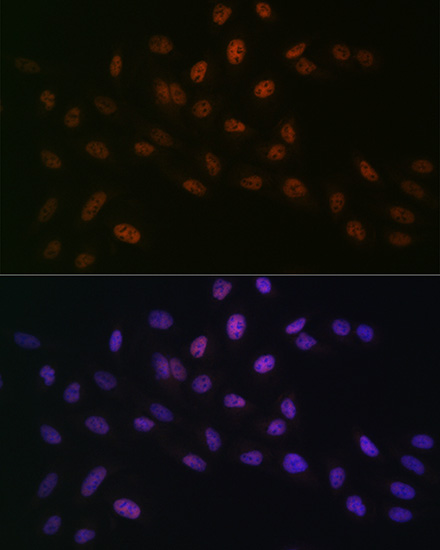 [KO Validated] MTA2 Rabbit monoclonal antibody