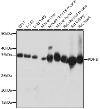 PDHB Rabbit monoclonal antibody