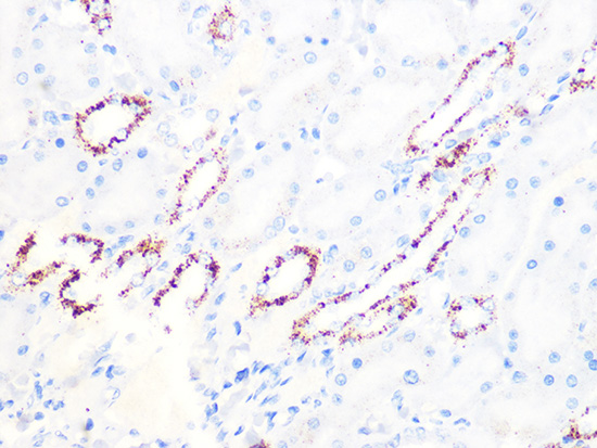 PDHB Rabbit monoclonal antibody