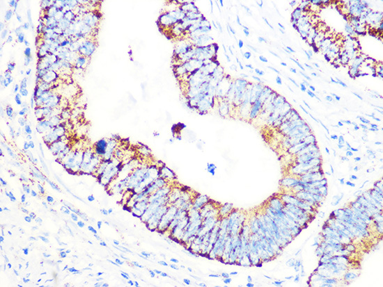 PDHB Rabbit monoclonal antibody
