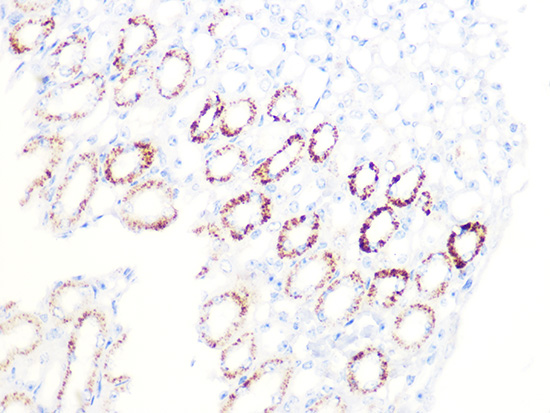PDHB Rabbit monoclonal antibody