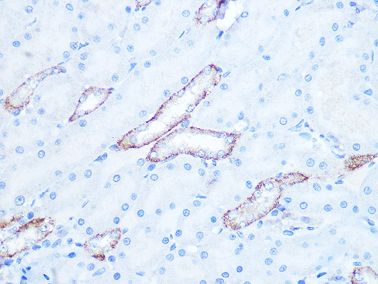 IRAK2 Rabbit monoclonal antibody
