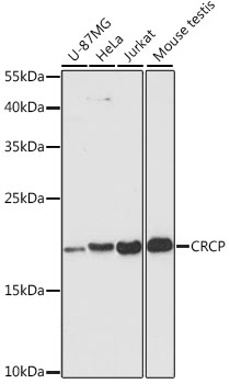 CRCP Rabbit polyclonal antibody