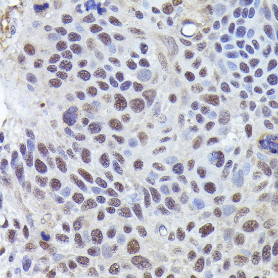 CRCP Rabbit polyclonal antibody
