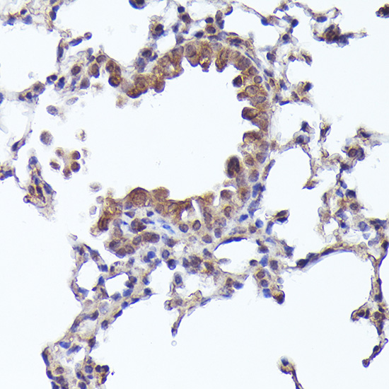 CRCP Rabbit polyclonal antibody