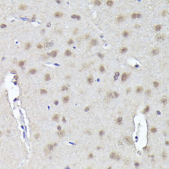 CRCP Rabbit polyclonal antibody