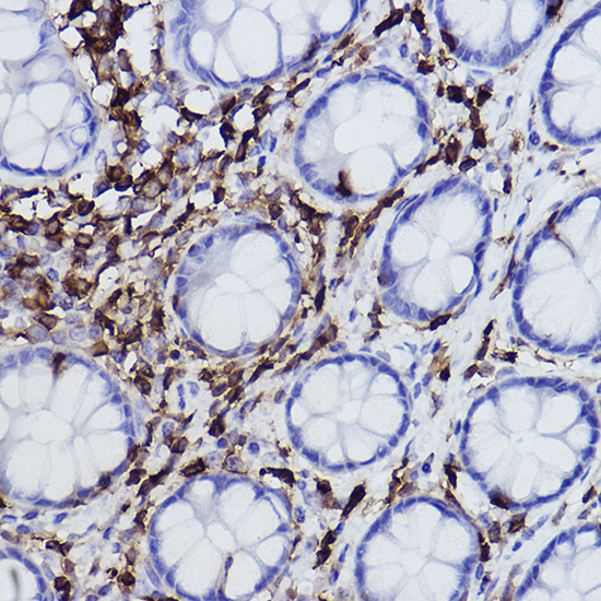 L-Plastin/LCP1 Rabbit monoclonal antibody