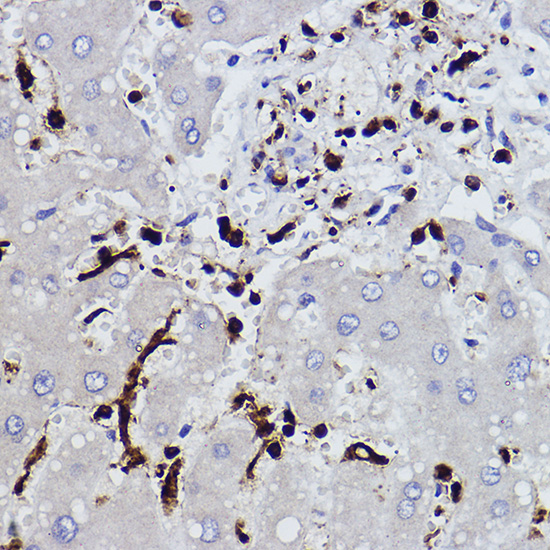 L-Plastin/LCP1 Rabbit monoclonal antibody