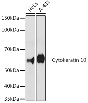 Cytokeratin 10 Rabbit monoclonal antibody