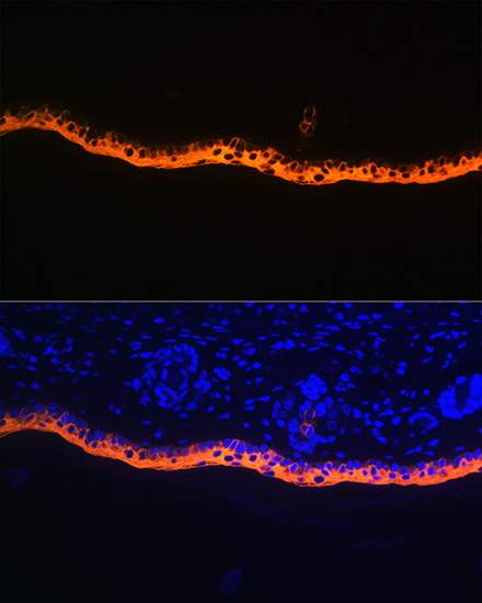 Cytokeratin 10 Rabbit monoclonal antibody
