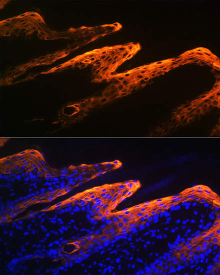 Cytokeratin 10 Rabbit monoclonal antibody