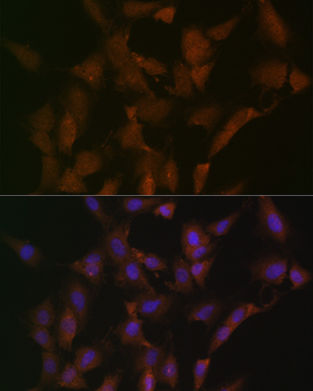 DISC1 Rabbit monoclonal antibody