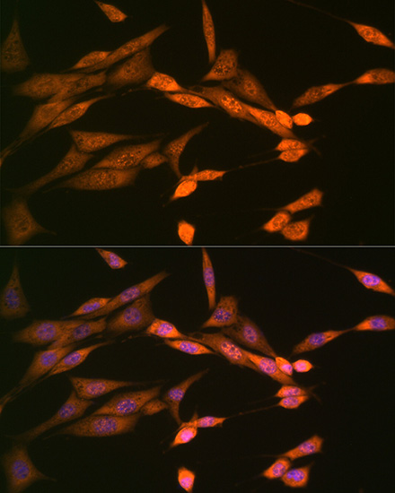 DISC1 Rabbit monoclonal antibody