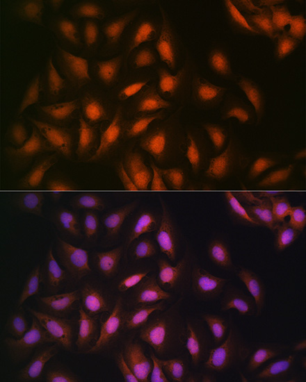 DISC1 Rabbit monoclonal antibody