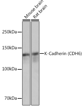 K-Cadherin (CDH6) Rabbit monoclonal antibody