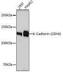 Western blot - K-Cadherin (CDH6) Rabbit mAb (A4689)