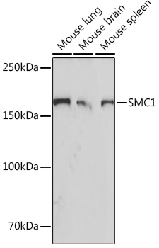 SMC1 Rabbit monoclonal antibody