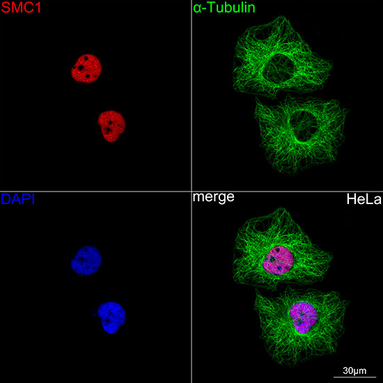 SMC1 Rabbit monoclonal antibody