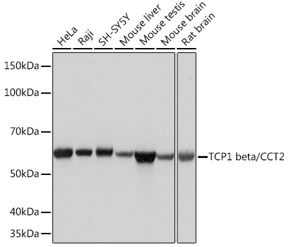 TCP1 beta/CCT2 Rabbit monoclonal antibody