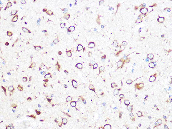 TCP1 beta/CCT2 Rabbit monoclonal antibody